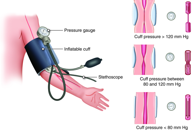 sphygmomanometer shown around upper left arm