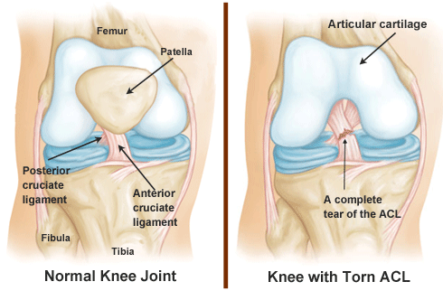 Knee joint